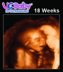 UC Baby 3D Ultrasound 18 Weeks
