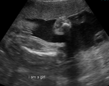 Scan gender confirmation Am I