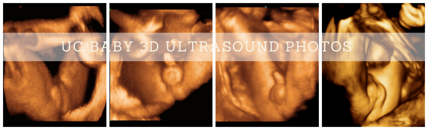 Gender Ultrasound photos UC BABY