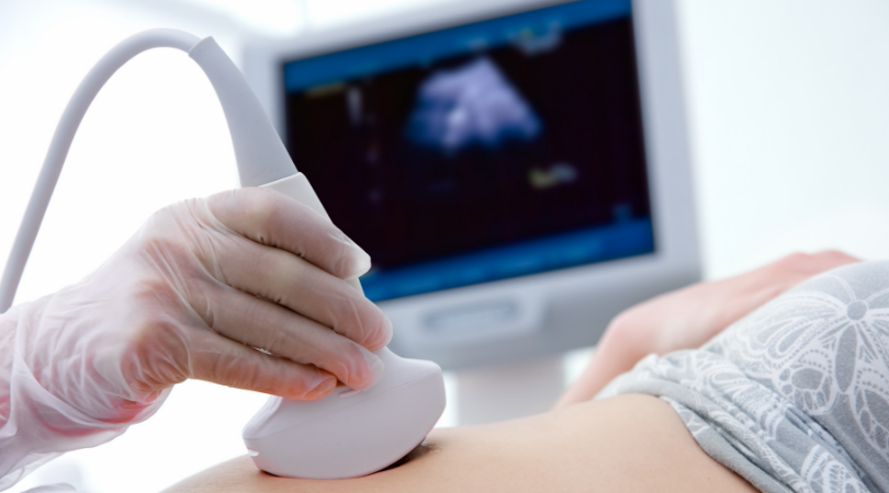pregnancy ultrasound