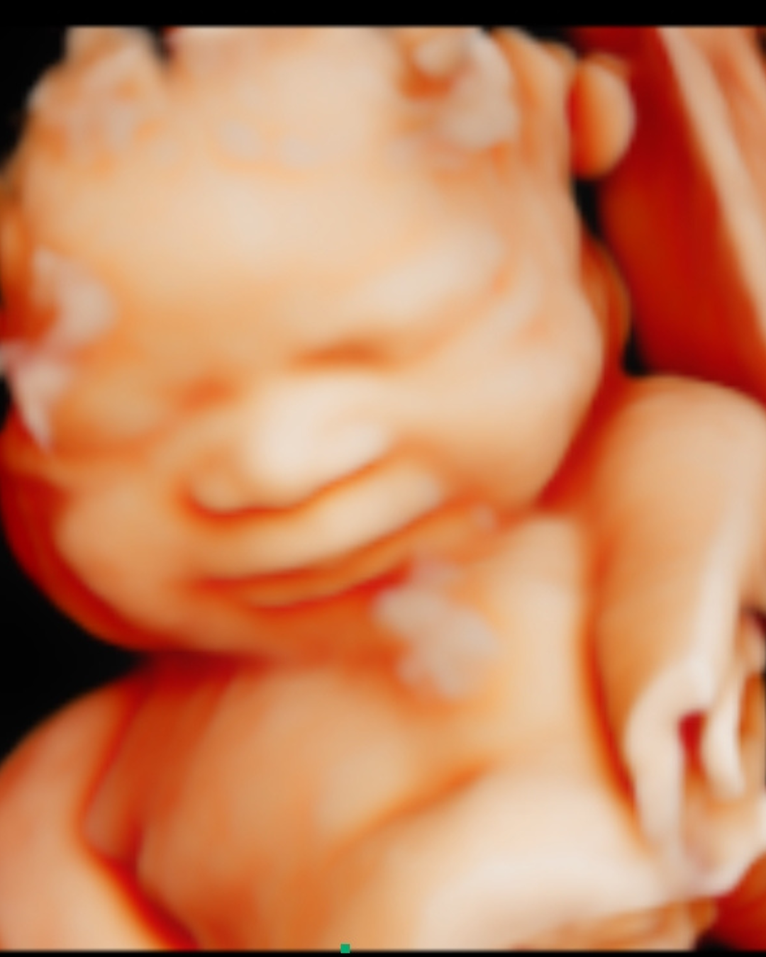 Gender Reveal Blood Test