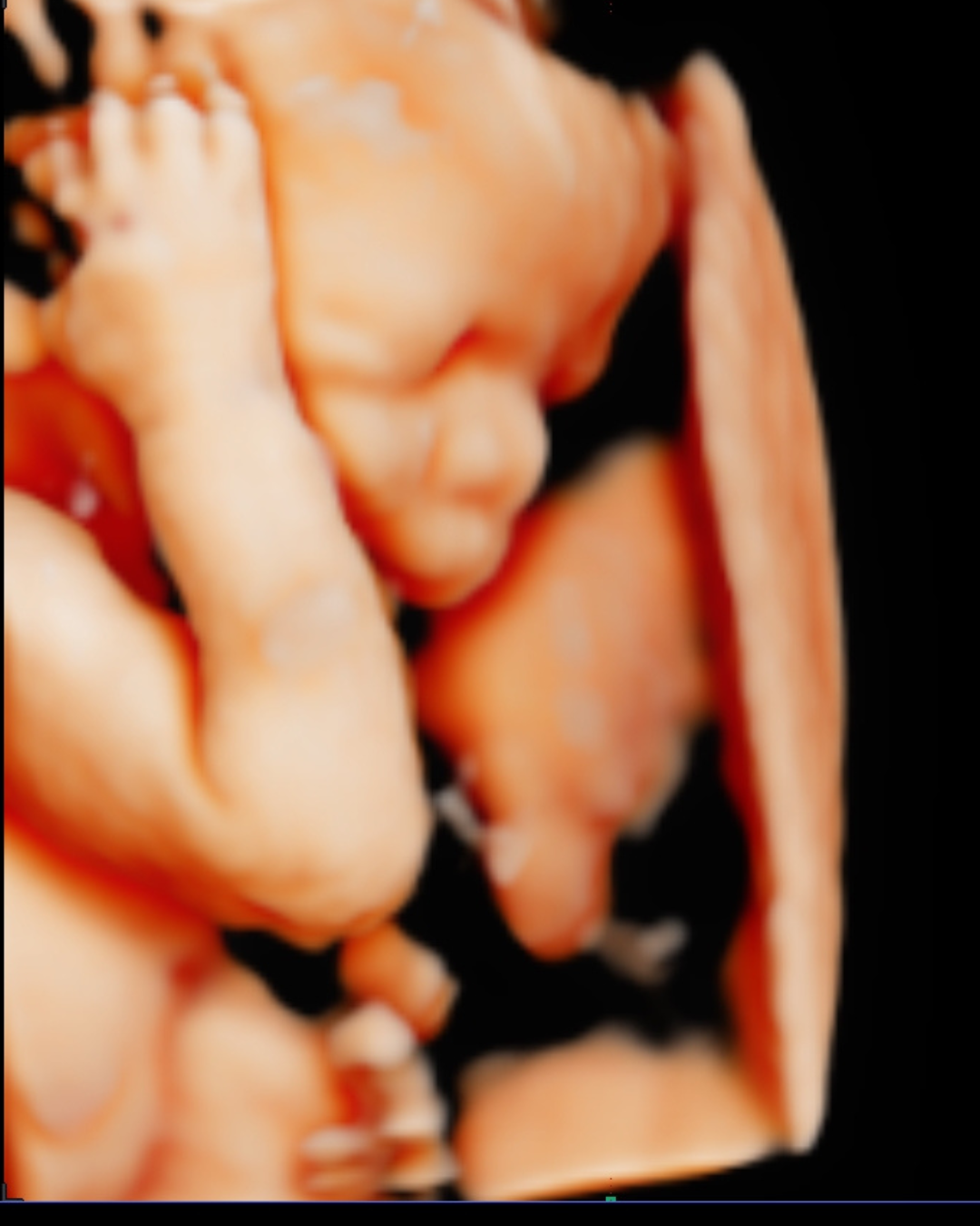 Gender Reveal Blood Test