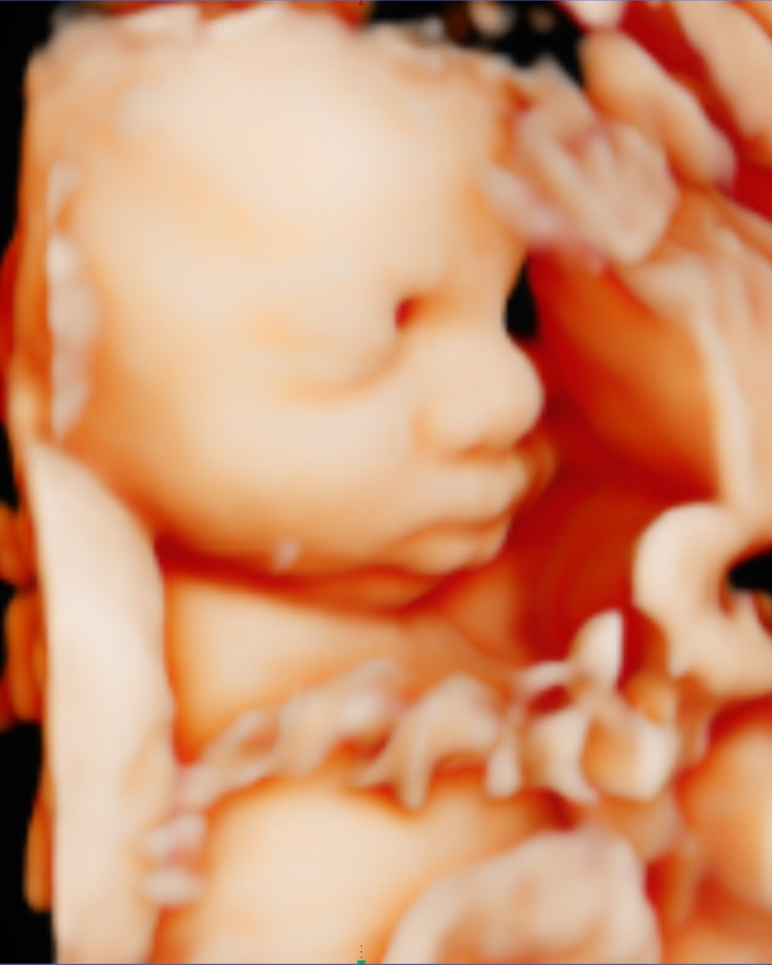 Gender Reveal Blood Test