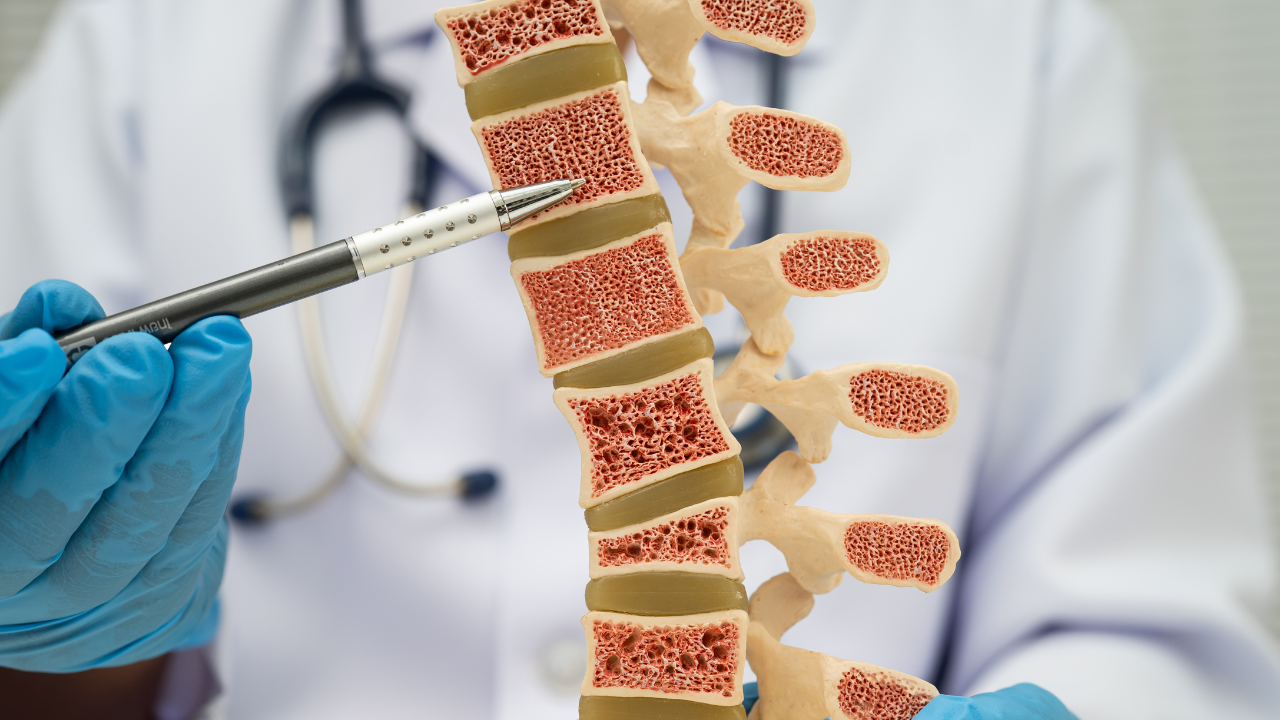 Bone Health Screening