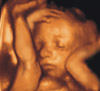 UC Baby 3D Ultrasound Photo 1
