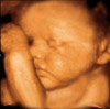 UC Baby 3D Ultrasound Photo 10