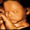 UC Baby 3D Ultrasound Photo 11