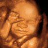UC Baby 3D Ultrasound Photo 12