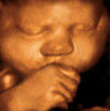 UC Baby 3D Ultrasound Photo 16