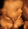 UC Baby 3D Ultrasound Photo 14