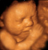 UC Baby 3D Ultrasound Photo 15