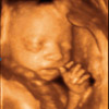 UC Baby 3D Ultrasound Photo 16