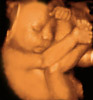 UC Baby 3D Ultrasound Photo 17