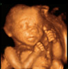 UC Baby 3D Ultrasound Photo 18