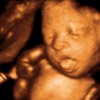 UC Baby 3D Ultrasound Photo 19