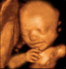 UC Baby 3D Ultrasound Photo 2