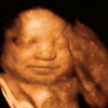 UC Baby 3D Ultrasound Photo 21