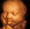 UC Baby 3D Ultrasound Photo 3
