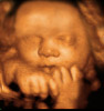UC Baby 3D Ultrasound Photo 4