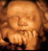 UC Baby 3D Ultrasound Photo 4
