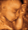 UC Baby 3D Ultrasound Photo 5