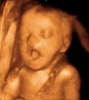 UC Baby 3D Ultrasound Photo 6