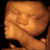 UC Baby 3D Ultrasound Photo 7