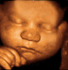 UC Baby 3D Ultrasound Photo 8