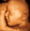 UC Baby 3D Ultrasound Photo 9