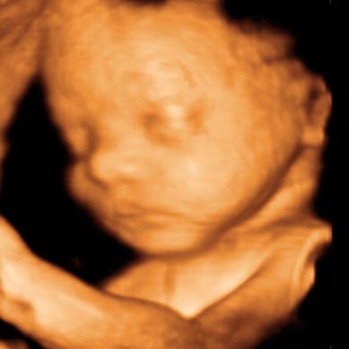 UC Baby 3D Ultrasound photo gallery 12