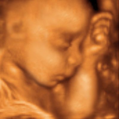 UC Baby 3D Ultrasound photo 10