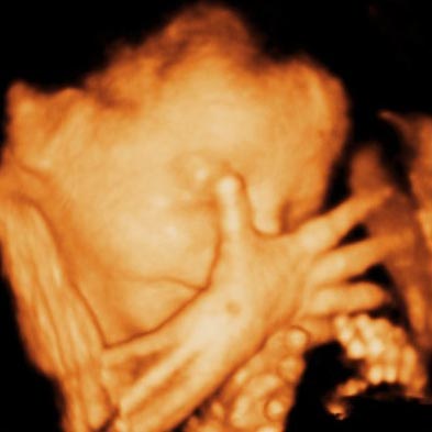 UC Baby 3D Ultrasound photo 9