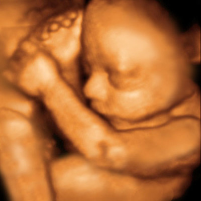 UC Baby 3D Ultrasound photo 8