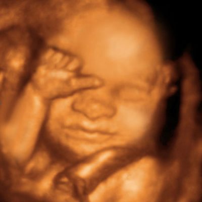 UC Baby 3D Ultrasound photo 6