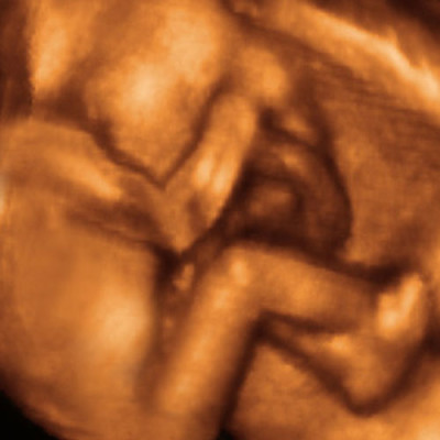 UC Baby 3D Ultrasound photo 5