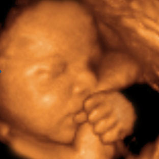 UC Baby 3D Ultrasound photo gallery 13