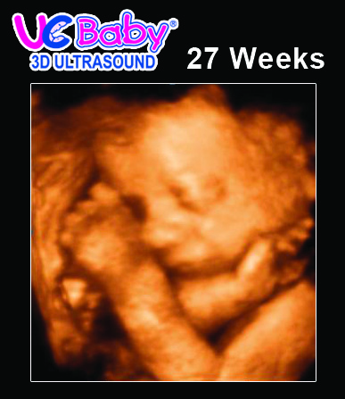 UC Baby 3D Ultrasound 27 WEEKS