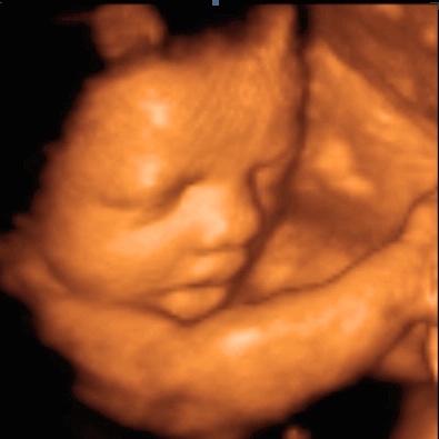 UC Baby 3D Ultrasound Image - tongue out