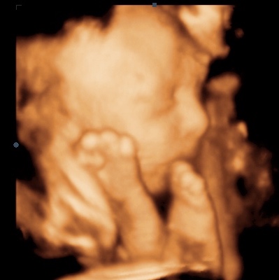 UC Baby 3D Ultrasound Image - feet near face