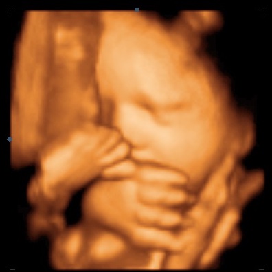 UC Baby 3D Ultrasound Image - foot on nose