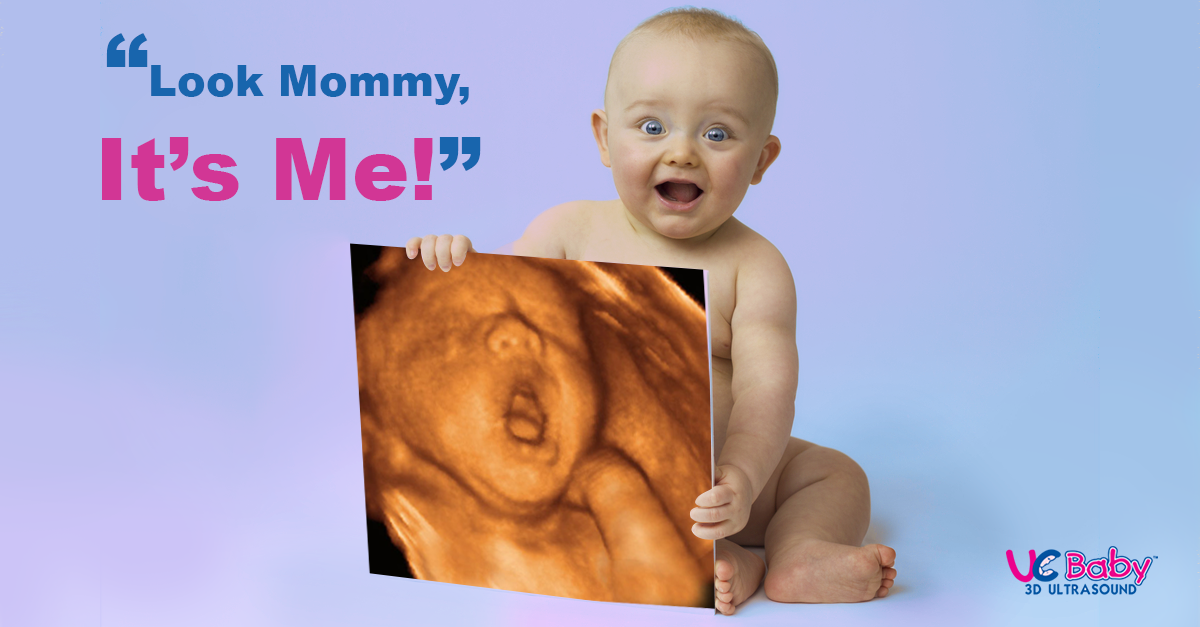 UC Baby 3D Ultrasound Photos