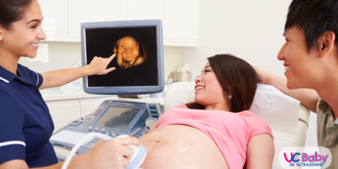 UCBABY 3d ultrasound draw