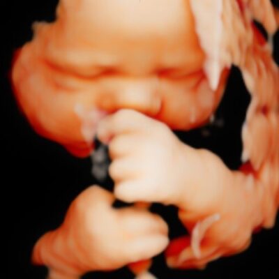 UC Baby 3D HD Ultrasound