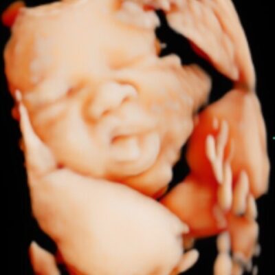 UC Baby 3D HD Ultrasound