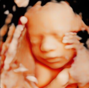 UC Baby 3D Ultrasound | 4D Ultrasound - Surrey, BC