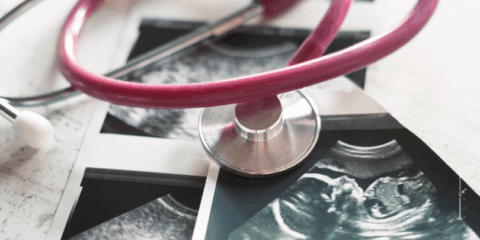 UC Baby Blog - What to Expect at Your 20-Week Anatomy Scan