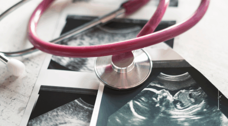 UC Baby Blog - What to Expect at Your 20-Week Anatomy Scan